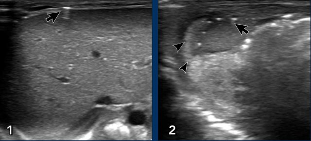 Images courtesy of Dr I Limantoro